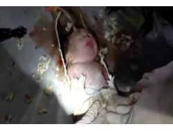 Tuvalete Atılan Bebek Atık Su Borusundan Kurtarıldı!