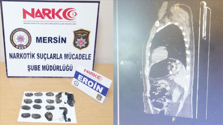 Midesinden 192 gram eroin çıktı!