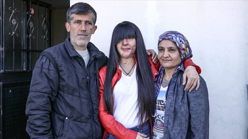 Asitli saldırı mağduru Berfin Özek ve ailesinden Erdoğan'a teşekkür