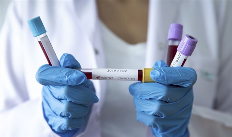 Çin’de ortaya çıkan yeni koronavirüsün kuluçka süresi 27 güne ulaşabilir