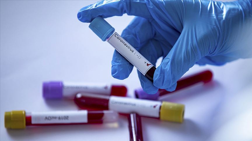 Akhisarspor'da 12 kişide koronavirüs tespit edildi