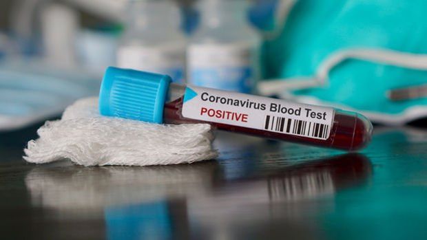 Dünya genelinde yeni tip koronavirüs vaka sayısı 25 milyon 413 bini aştı!