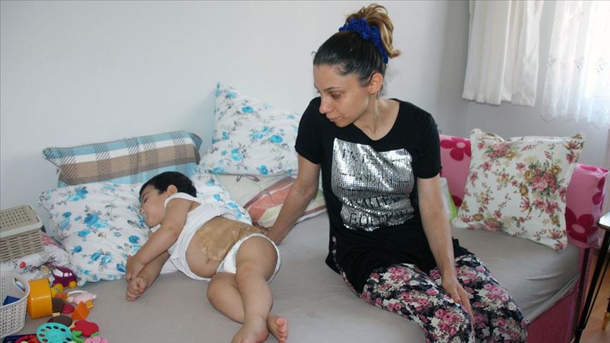 Minik Berat'ın ailesi çocuklarının sağlığına kavuşacağı günü bekliyor