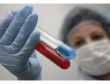Yeni HIV aşısı başarılı oldu!
