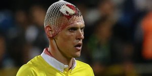Fenerbahçe'de Skrtel'in başına 10 dikiş atıldı!