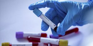 Meclis Hastanesinde görevli doktorun ikinci Kovid-19 testi pozitif çıktı!