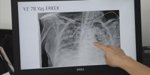 Zatürre bu yıl çok daha tehlikeli bir hastalık