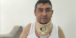 Manavgatlı Çiftçi, Kendisini Yaralayan Aslanın Öldürülmesinin Üzüntüsünü Yaşıyor
