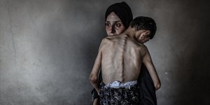 GAZZE ŞERİDİ'NDE SON 24 SAATTE 5 FİLİSTİNLİ DAHA AÇLIKTAN HAYATINI KAYBETTİ