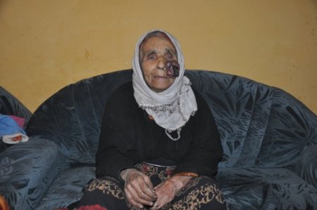 105 Yaşındaki Kadını Yanmaktan Komşuları Kurtardı