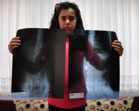 12 yaşındaki öğrenci 2 aydır midesindeki 1 lira ile yaşıyor