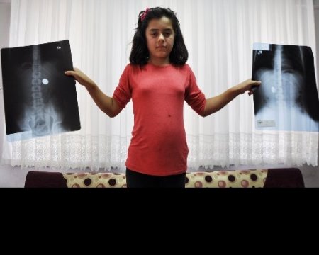 12 yaşındaki öğrenci 2 aydır midesindeki 1 lira ile yaşıyor