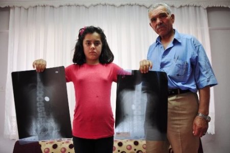 12 yaşındaki öğrenci 2 aydır midesindeki 1 lira ile yaşıyor