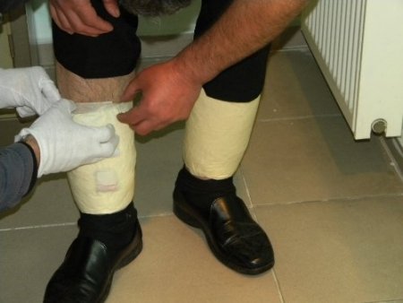 5 bin 550 adet uyuşturucu hapı bacağına sardı