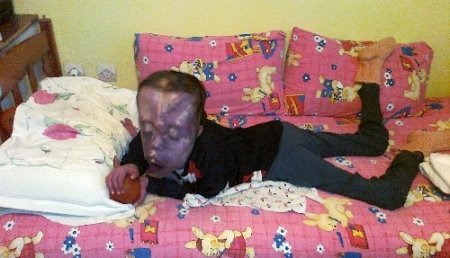 6 ay yaşar dedikleri oğlunu anne sevgisi ile 18 yıl yaşattı (Özel)