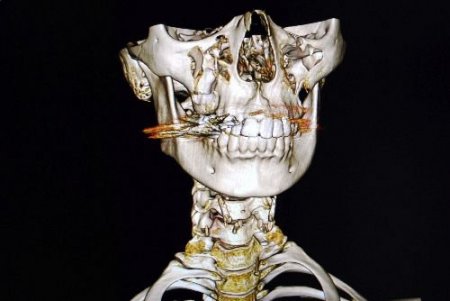 Adıyaman Devlet Hastanesi'nde Röntgen Görüntüleme Sistemi Hizmete Girdi