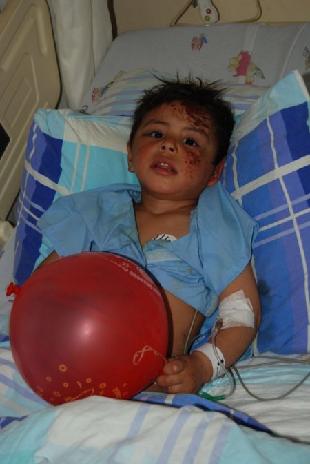 Ailesi bombalanan 3 yaşındaki Suriyeli bebek Gaziantep'te yeniden hayata döndü