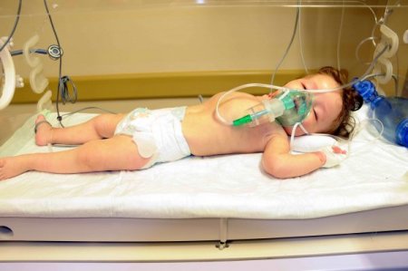 Alkolik Babanın Darp Ettiği Edanur Bebeğin Beyin Ameliyatı Olumlu Geçti