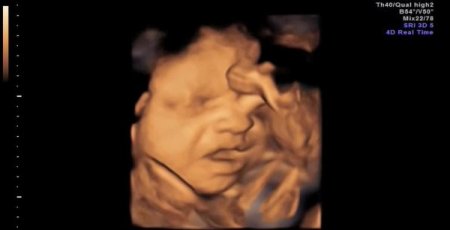 Anne karnındaki bebeğin esnemesi görüntülendi