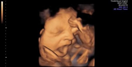 Anne karnındaki bebeğin esnemesi görüntülendi