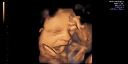 Anne karnındaki bebeğin esnemesi görüntülendi