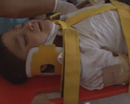 Asansör boşluğuna düşen çocuk ağır yaralandı