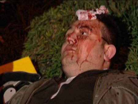 Aşırı Hız Nedeniyle Takla Atan Otomobilin Sürücüsü Yaralandı