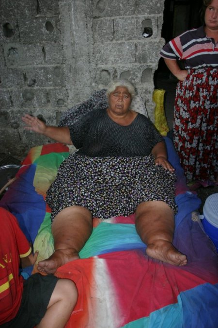 Aşırı kilolu ve sağlığı bozuk yaşlı kadına bakan hastane yok!