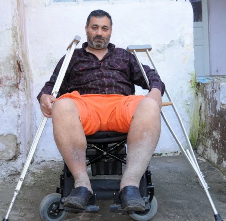 Askerde falakaya yatırılarak dövülen Özen, 28 yıldır yürüyemiyor (Özel)