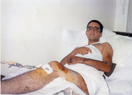 Askerde yaralanıp yüzde 37 engelli oldu, 14 yıldır gazilik mücadelesi veriyor