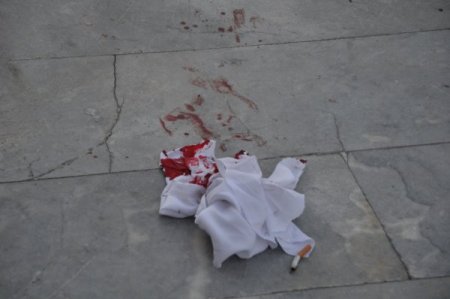 Askerlikten firar edip boşandığı eşini 3 yerinden bıçakladı