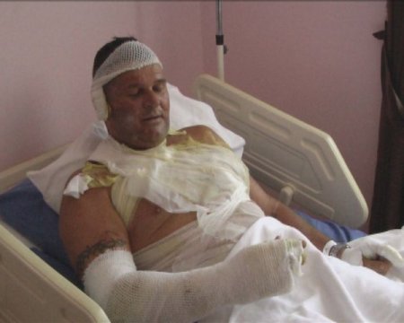 Ateşte Balık, Turistleri Yaktı