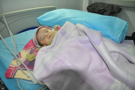 Babasından şiddet gördüğü iddia edilen 7 aylık bebek yoğun bakımda