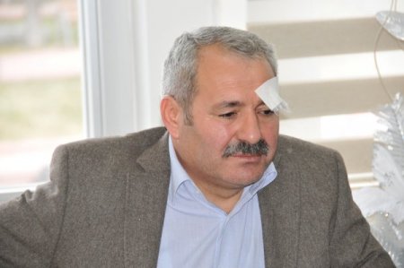 Bahçede seyyarlara satış yaptırmıyor diye hastane yöneticisi darp edildi