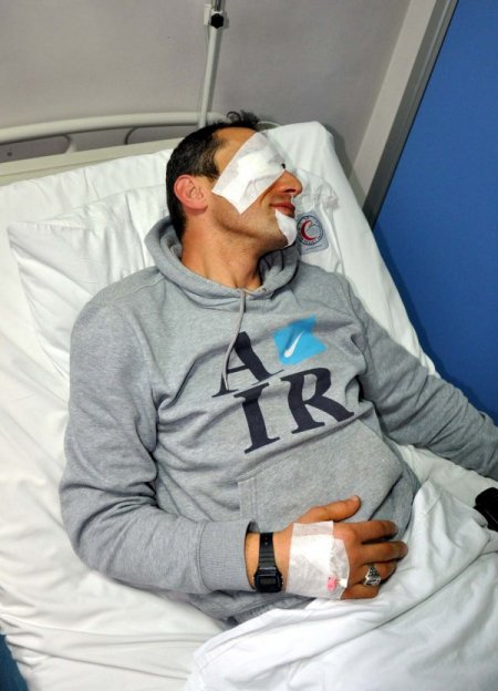 Beslediği yabani kurt hastanelik etti