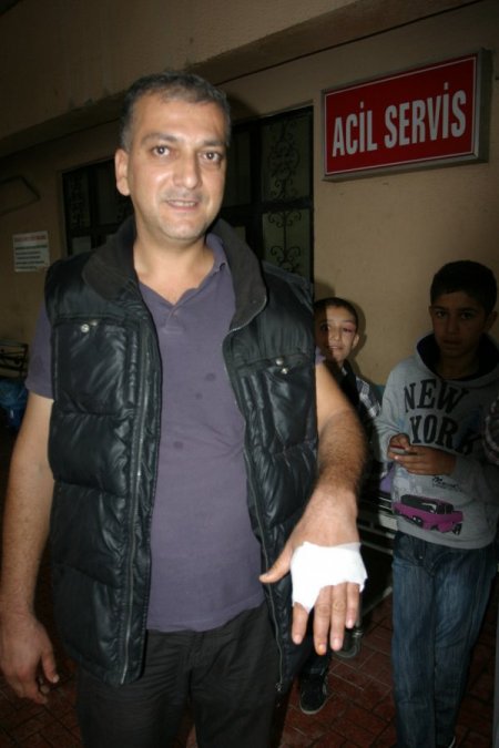 Bıçak bilerken elini kesen acemi kasaptan, kameramana şapkalı tepki