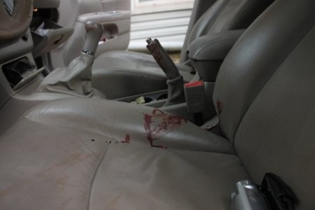 Bıçakla yaralandı, kendi arabasıyla hastaneye geldi