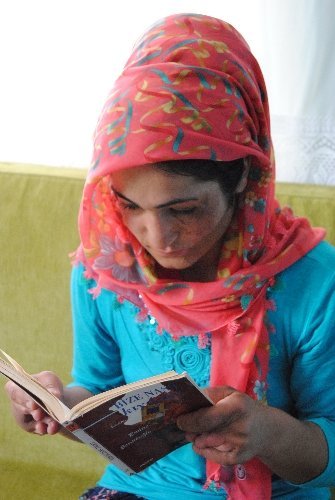 Bir yaşında yüzü yanan Sakine estetik ameliyat için yardım bekliyor