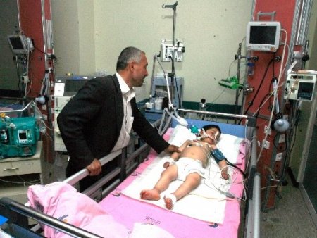 Çatapat yutan iki çocuğun karaciğerleri iflas etti