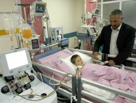 Çatapat yutan iki çocuğun karaciğerleri iflas etti