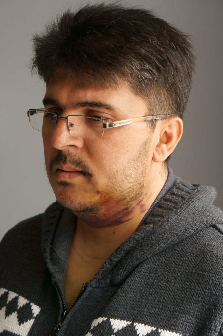 Cihan kameramanı Bilal Oflaz taburcu edildi