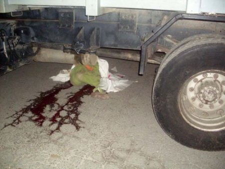 Çöp Arabasının Altında Kalan Çöpçü, Öldü