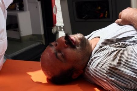 Dhkp-c'lilerin Duruşması Öncesi Çıkan Olaylarda 68 Kişi Gözaltına Alındı