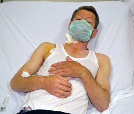 Diyalize bağımlı yaşamaktan kurtuldu