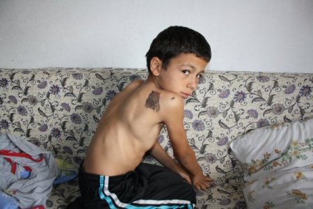 Doğuştan sağ kaburga kemiği olmayan Cafer'in dramı yürek burkuyor