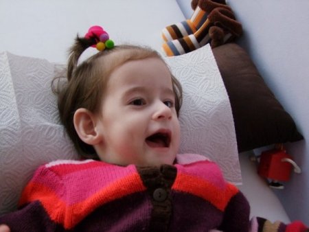 Doktorların 'yaşamaz' dediği hidrosefali hastası Öykü 2 yaşına girdi