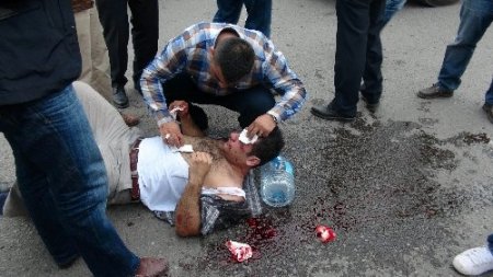 Dolmuş şoförlerinin darp ettiği sürücü yaralandı