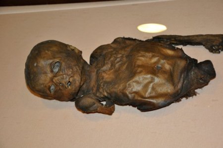 Dünyada İç Organlarıyla Mumyalanan Örnekler Yalnızca Amasya’da