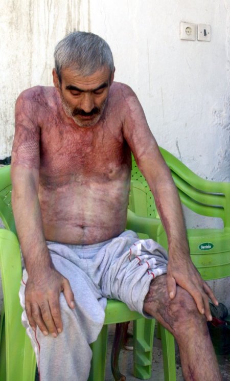 Elektrik akımına kapılan boya ustası, yardım bekliyor