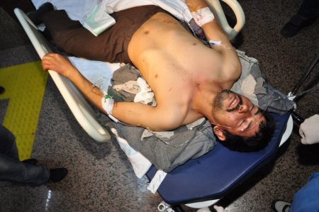 Elindeki orağı yanlışlıkla sırtına sapladı